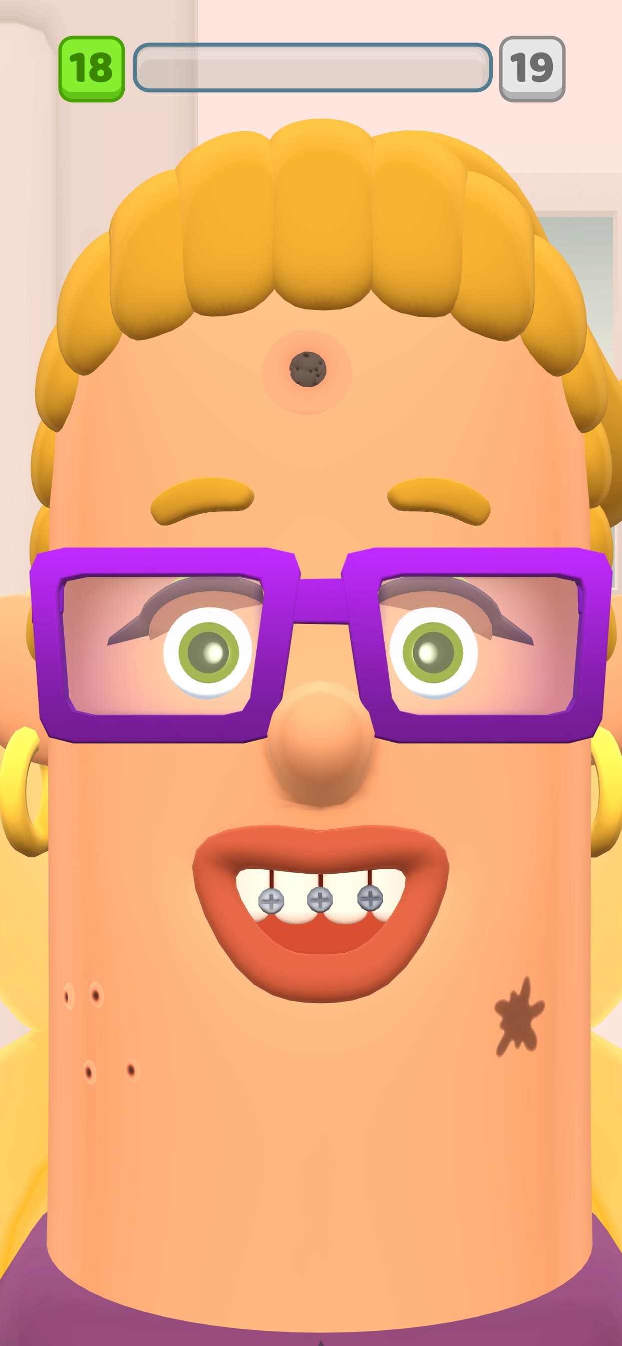 Pimple Popping! screenshot 1 - screenshot