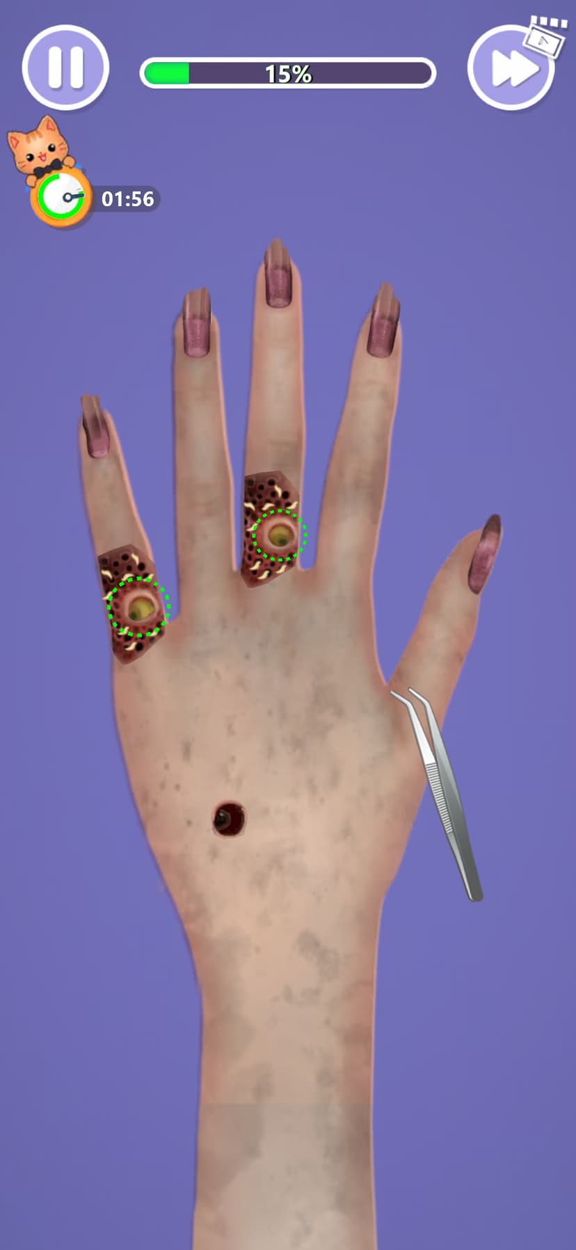 Skin Makeover: Relax ASMR Game screenshot 1 - screenshot