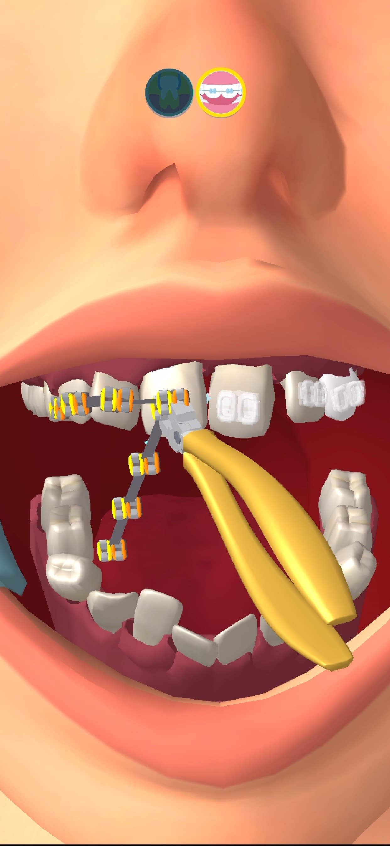 Perfect Smile screenshot 2 - screenshot